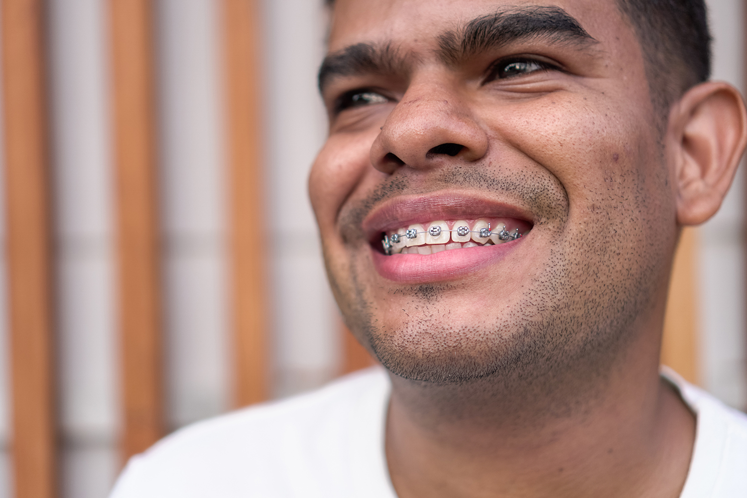 adult male smiling with metal braces from the smile design