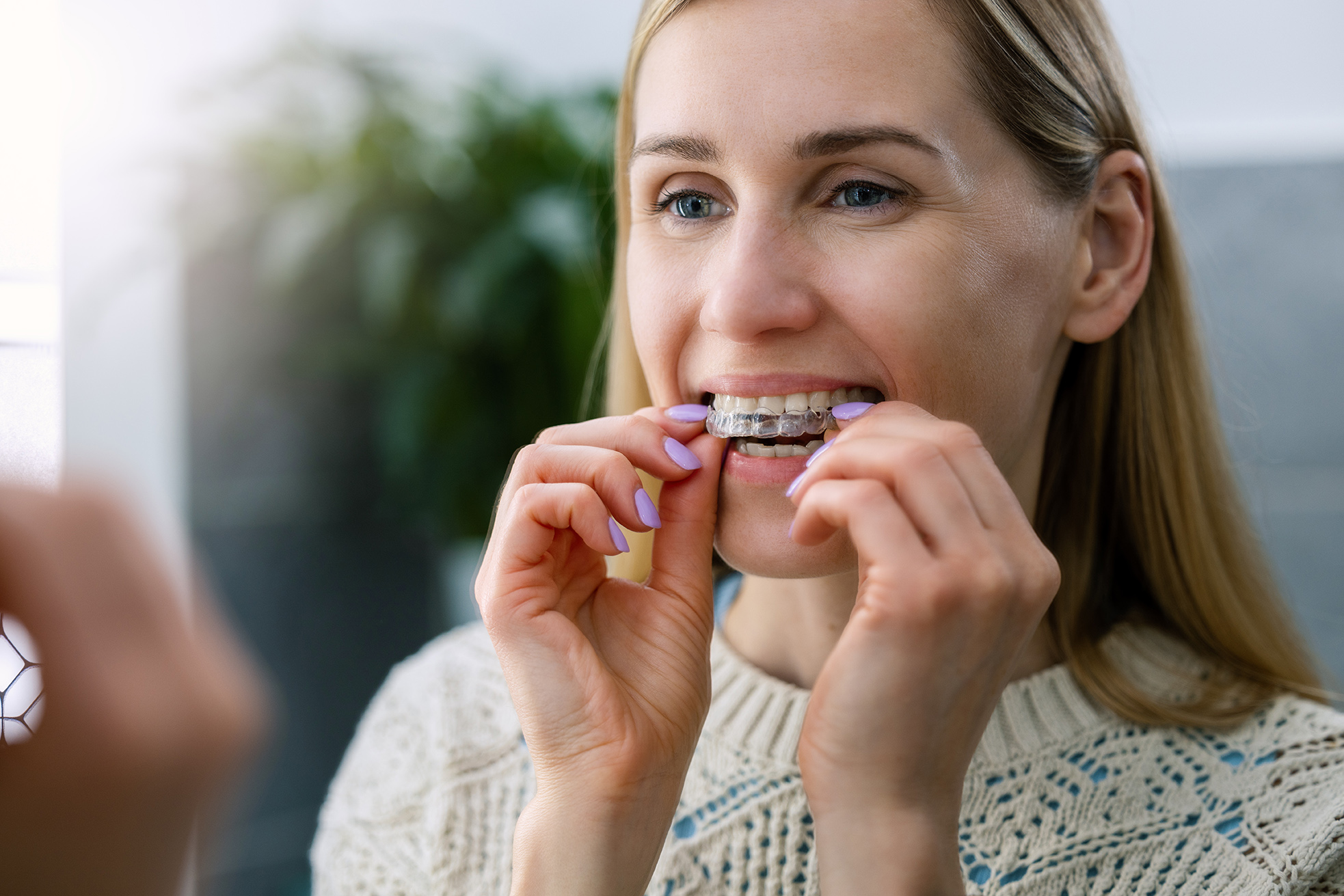 woman inserting clear dental aligners from the smile design 